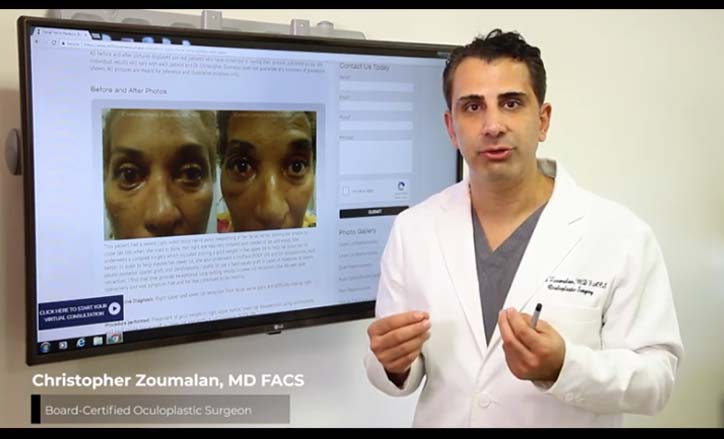 Facial Paralysis Bell’s Palsy - Click to view the Video