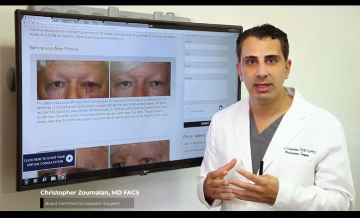 Eyelid Skin Cancer - Click to view the Video