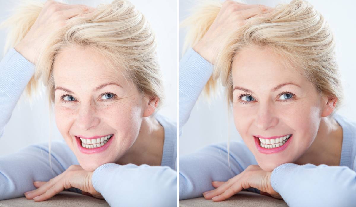 Benefits of non-surgical rejuvenation for middle aged woman.