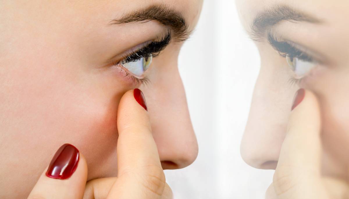 woman checking if under eye bags need surgery