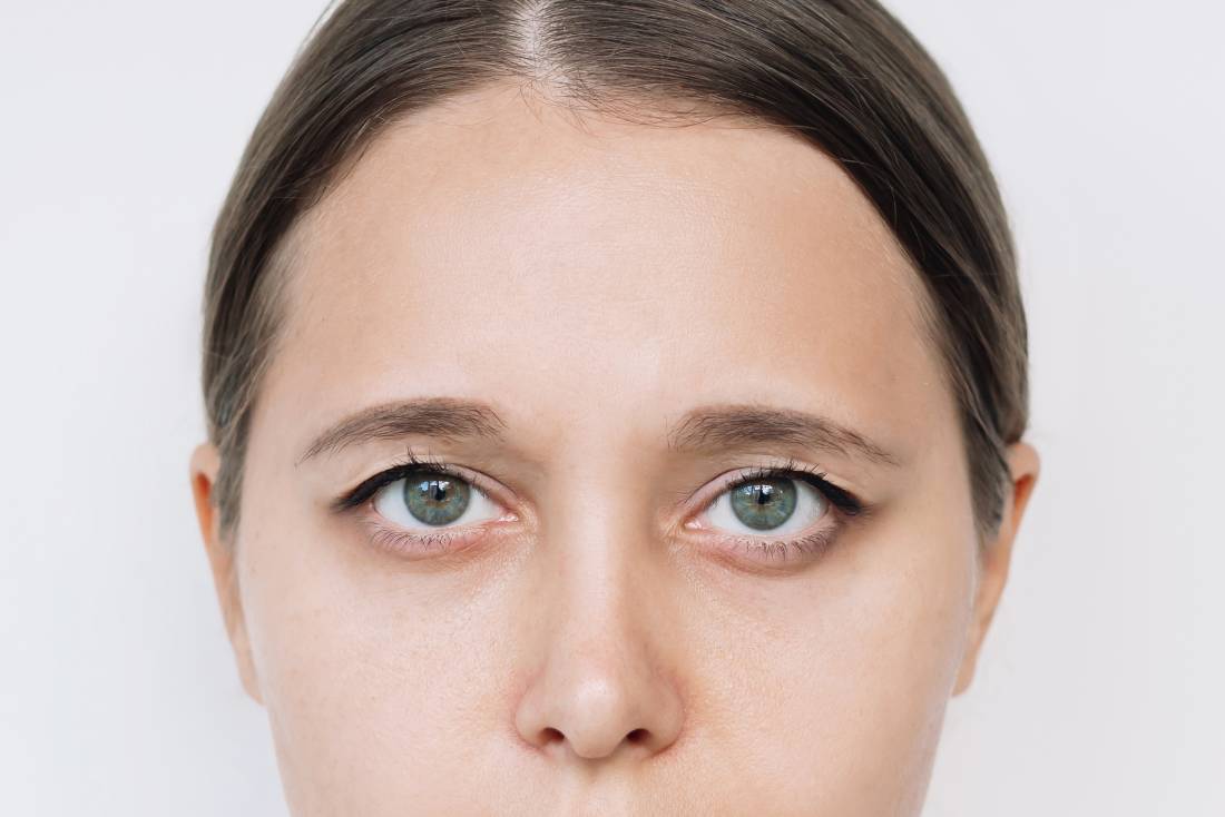 Featured image for Consequences of Ignoring Ptosis